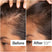 Before/After of hair growth when using Act+Acre Stem Cell Serum