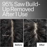 Before/After of scalp when using Act+Acre Vitamin E Scalp Detox Oil