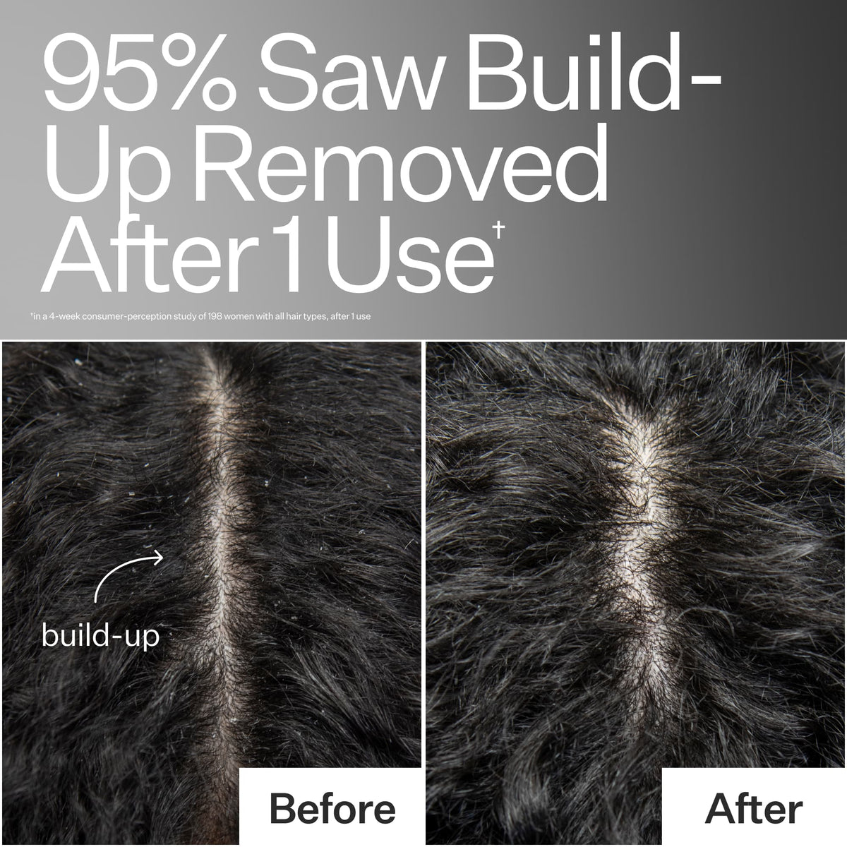 Before/After of scalp when using Act+Acre Vitamin E Scalp Detox Oil