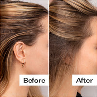 Before/After of scalp and hair after using Act+Acre Fulvic Acid Volumizing Dry Shampoo