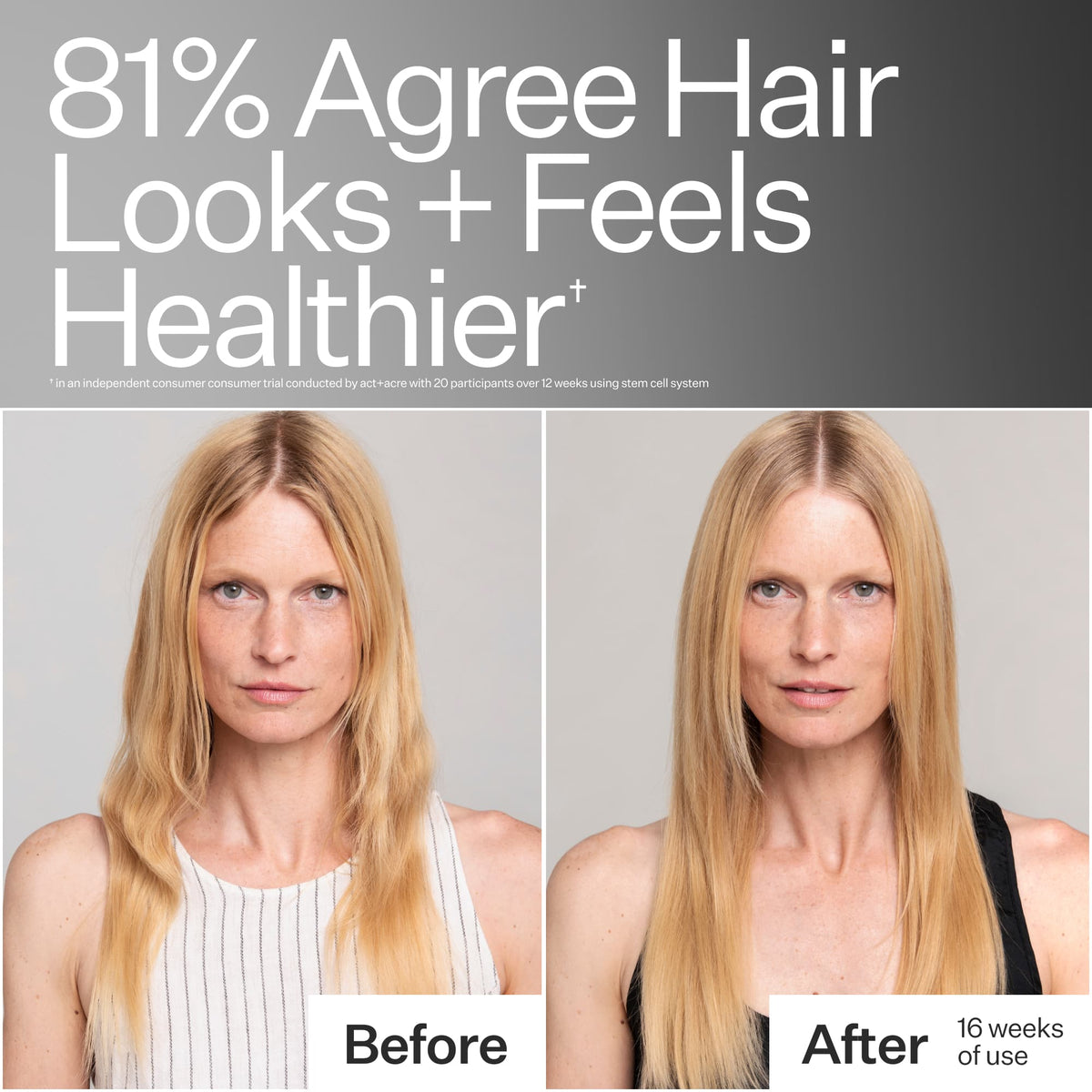 Before/After of woman with long, blonde hair using Act+Acre Stem Cell Shampoo