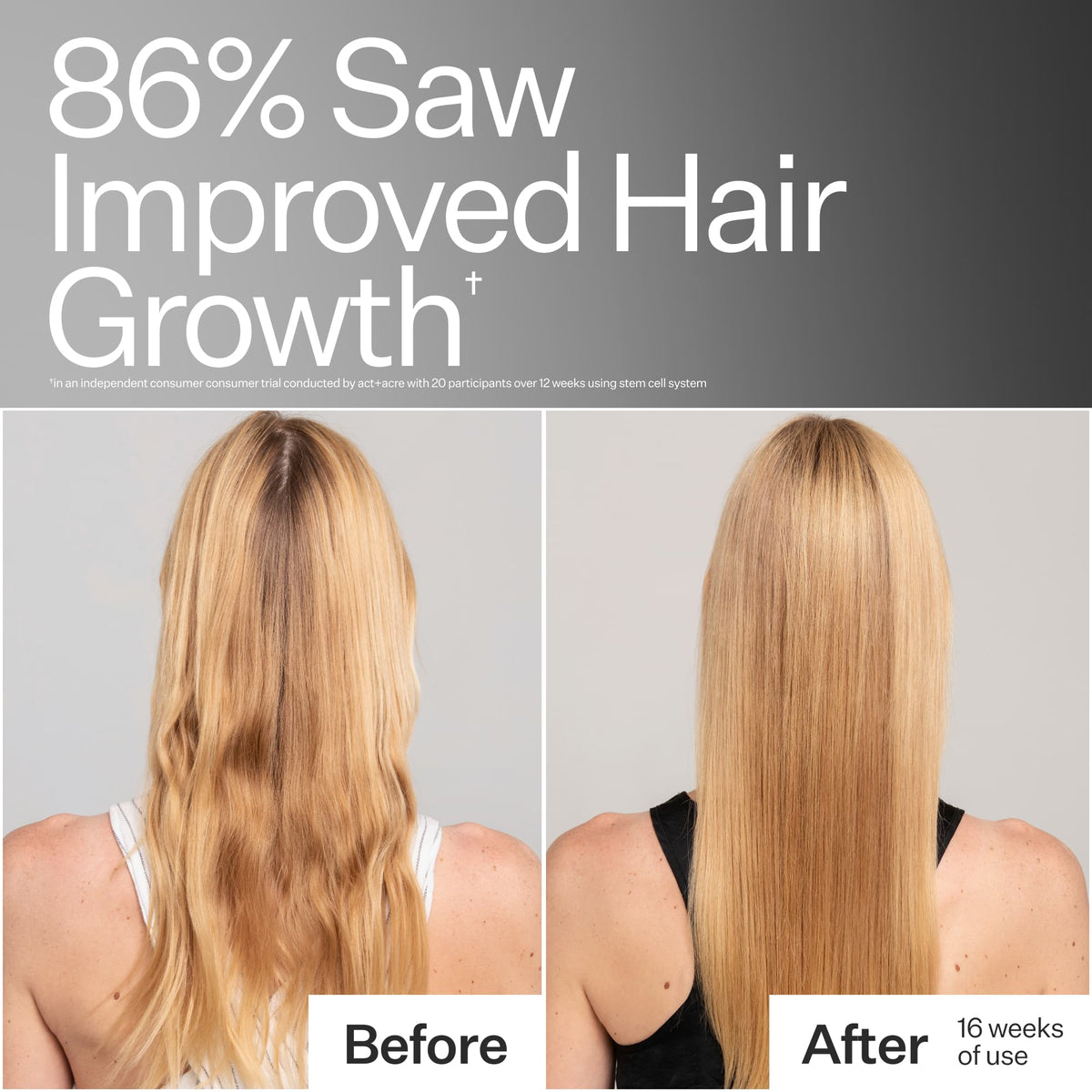Before/After of woman with long, blonde hair using Act+Acre Stem Cell Shampoo