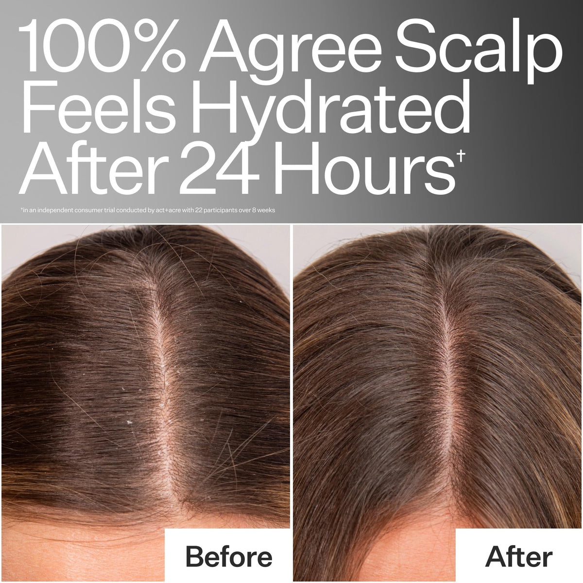 Before and after comparison of scalp hydration with text indicating scalp feels hydrated after 24 hours.